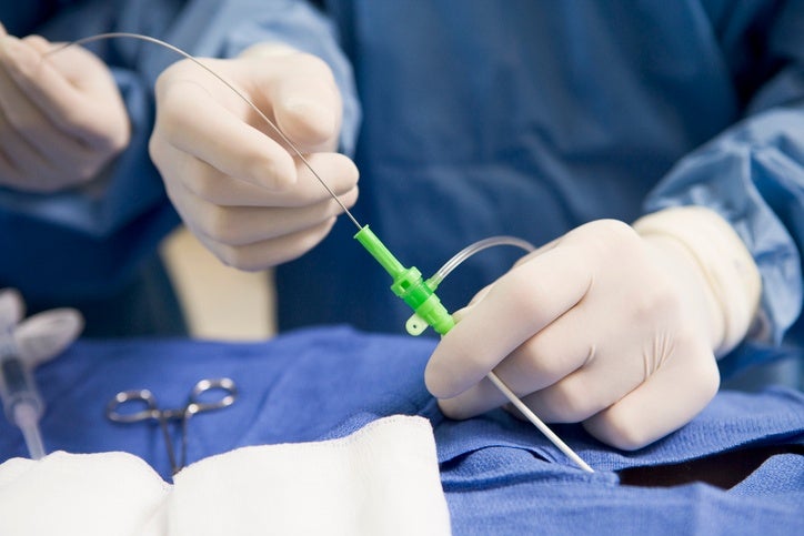 Cardiac catheterization procedure with catheter insertion Sugar Land, TX